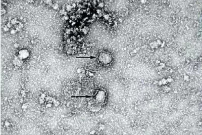 За пределами Китая зафиксирована первая смерть от коронавируса